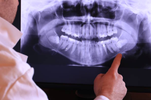 Best Urgent Tooth Repair  in Salmon, ID